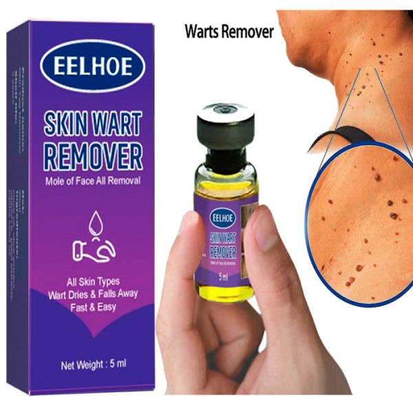 Achill Remover ( আচিল রিমুভার)
